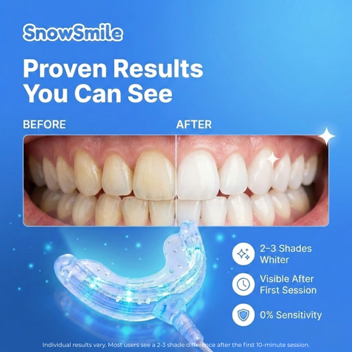 SnowSmile Teeth Whitening LED Device